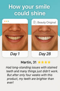 Whitening LED electric toothbrush